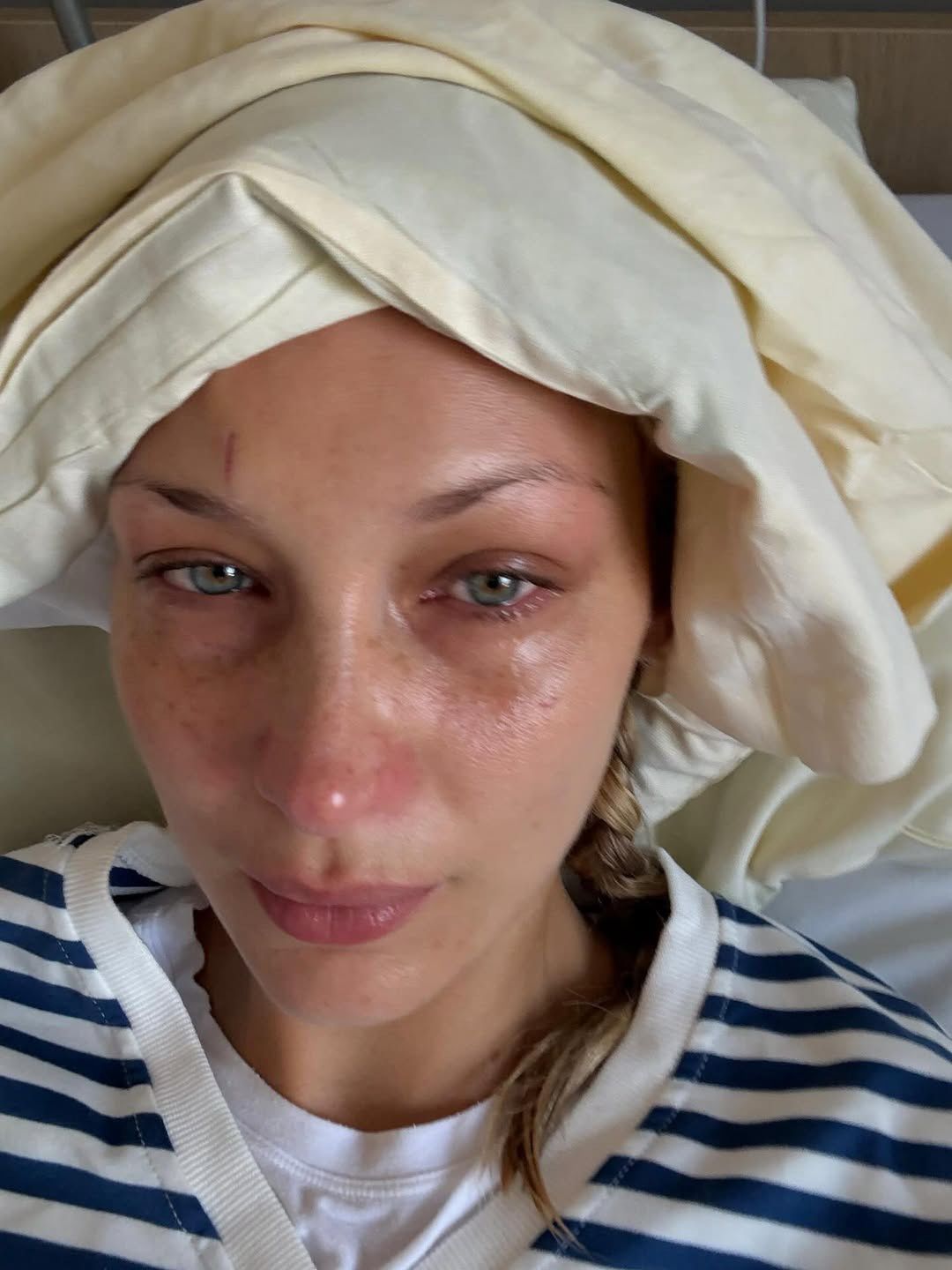 Bella Hadid jest w szpitalu