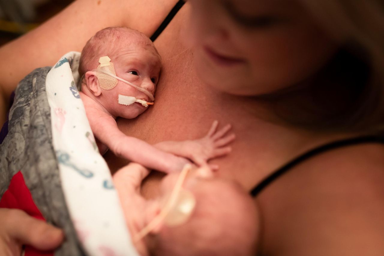 Eksperci nie mają wątpliwości. Kangurowanie wzmacnia odporność wcześniaków