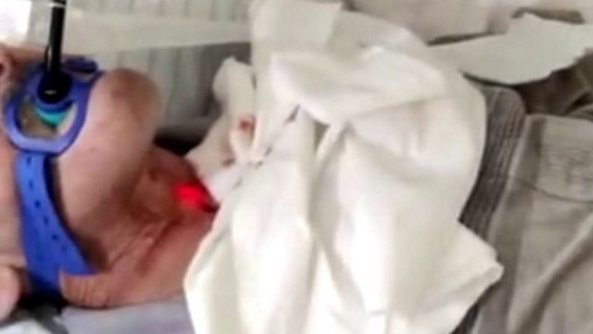 Lekarze wykonali nowatorski zabieg