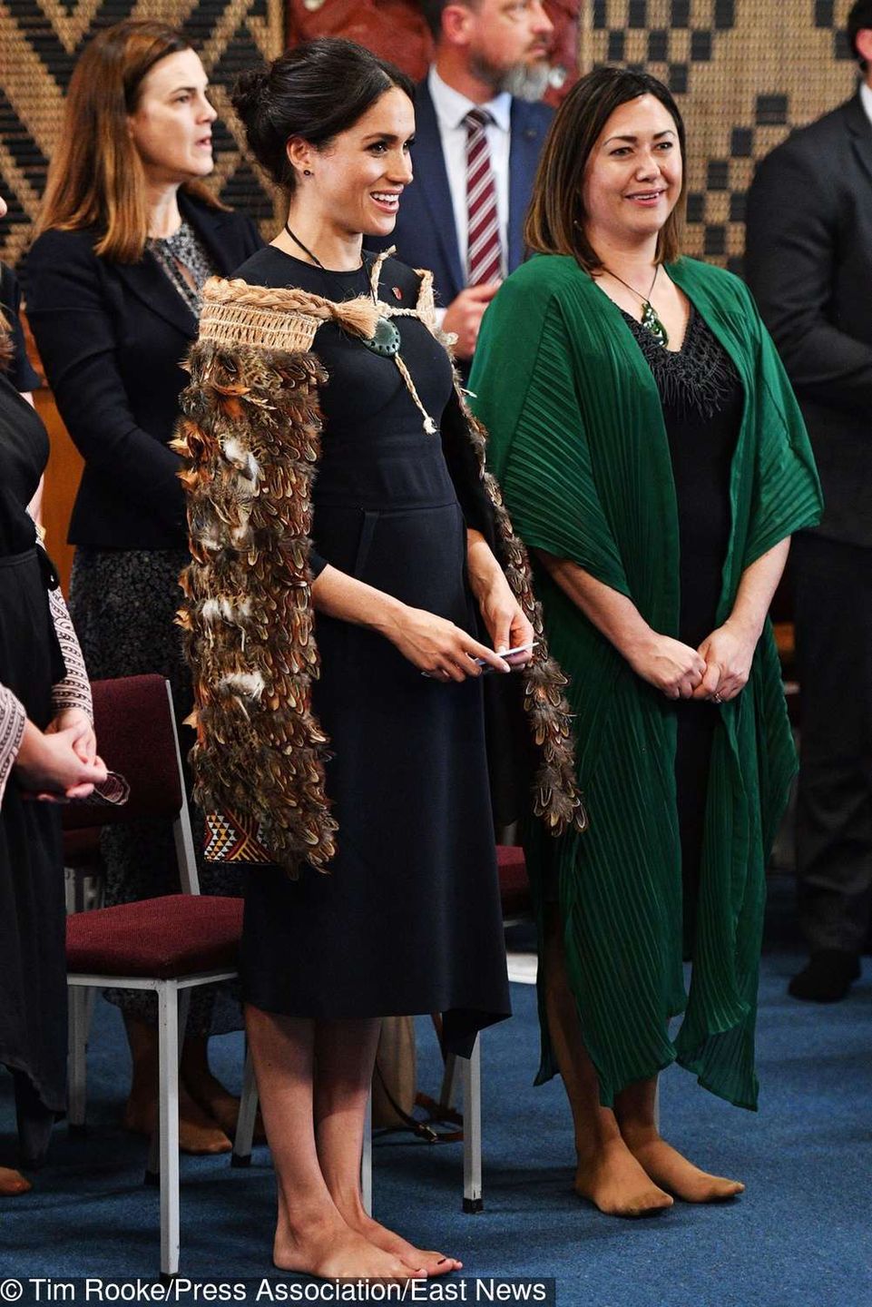 Meghan Markle ma problem z haluksami