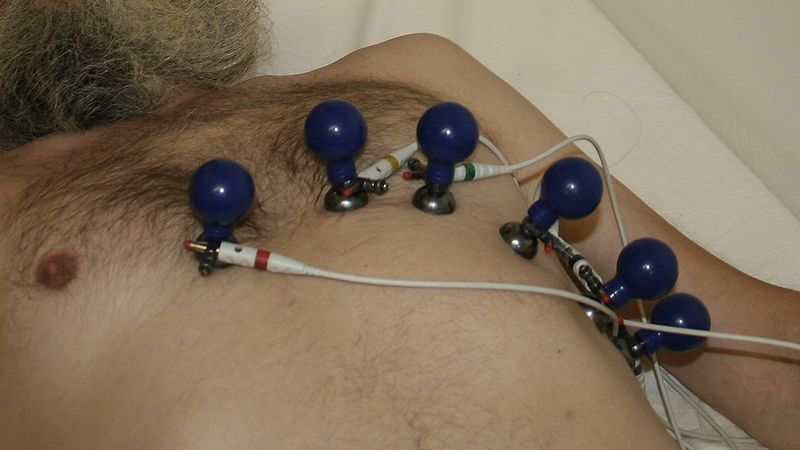 iPhone zamieniony w elektrokardiograf [wideo] 1