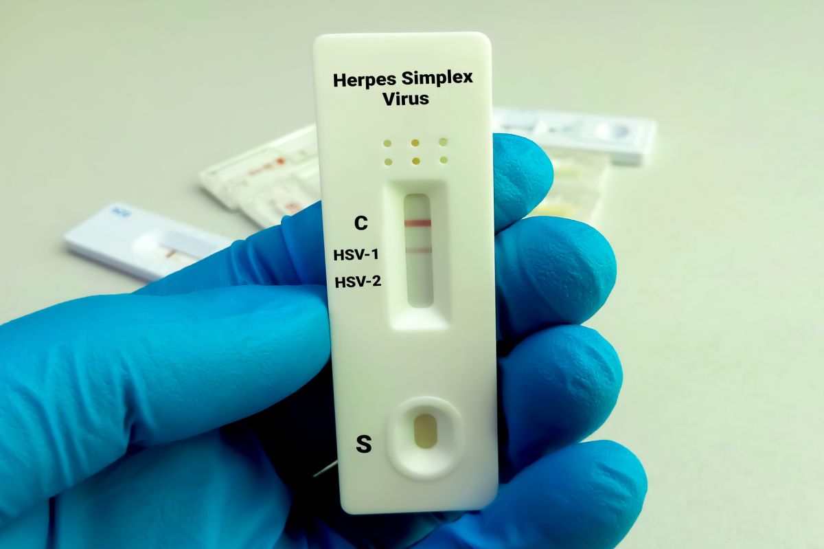 Herpes virus suspected in Alzheimer's: New research insights
