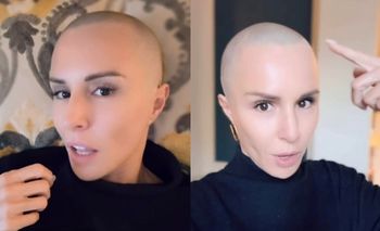 Blanka Lipińska opisuje moment, gdy pierwszy raz zobaczyła swoją łysą głowę: "To było jak ZDERZENIE Z POCIĄGIEM"