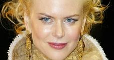 Kidman - królowa botoksu?