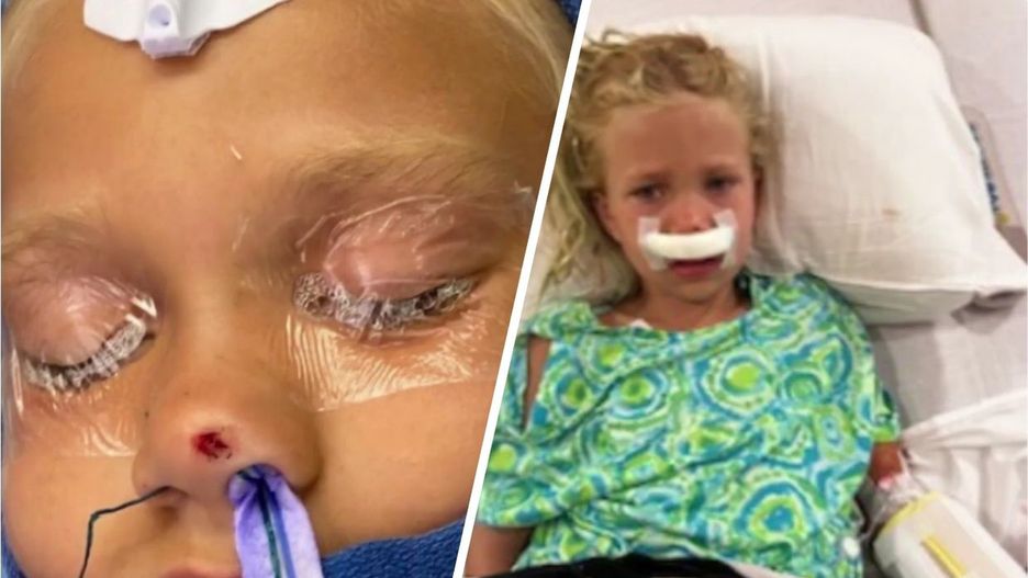 Dziewczynka, której strzałka utknęła w czaszce