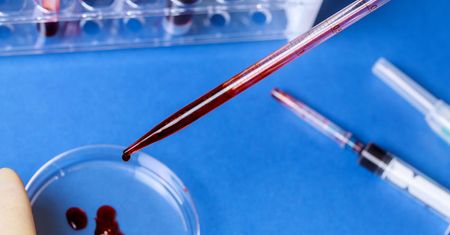 HCV przeciwciała – charakterystyka, wskazania, opis badania, wynik badania