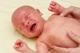 Wysypka u dziecka i niemowlaka - pokrzywka alergiczna, gorączka trzydniowa, różyczka, odra, ospa, trądzik, potówki