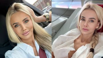 Monika Chwajoł z "Królowych życia" wraca do zdrowia po OPERACJI i ujawnia szczegóły. "Teraz organizm uczy się funkcjonować bez pęcherzyka"