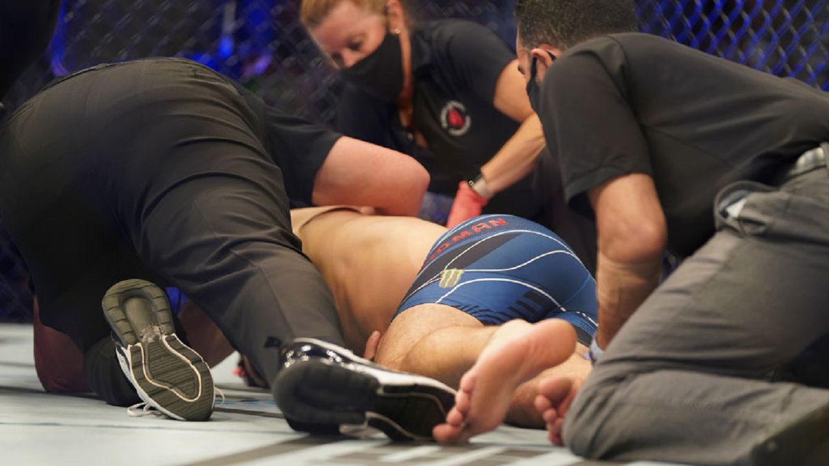 Zdjęcie okładkowe artykułu: Getty Images / Louis Grasse/PxImages/Icon Sportswire / Na zdjęciu: Chris Weidman doznał złamania nogi podczas walki na gali UFC