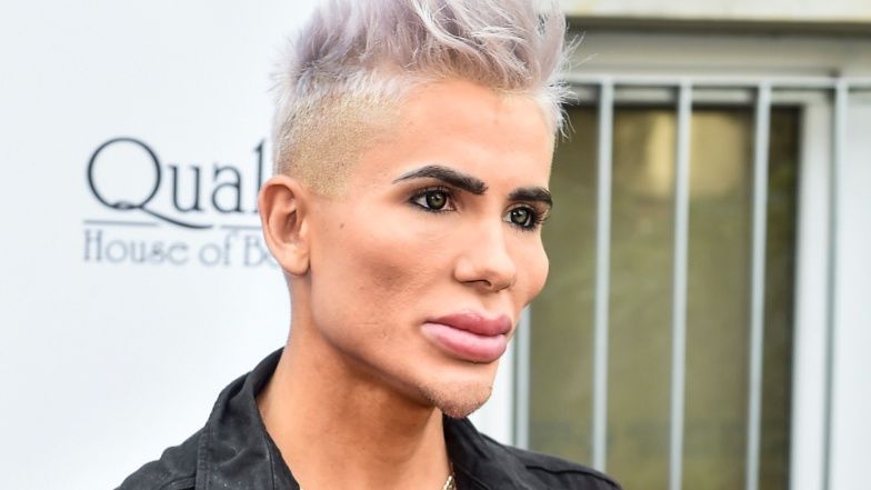 "Polski Ken" planuje KOLEJNE operacje plastyczne