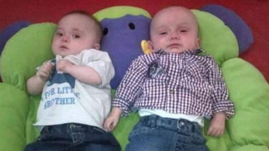 Jedno z bliźniaków urodziło się z zespołem Downa