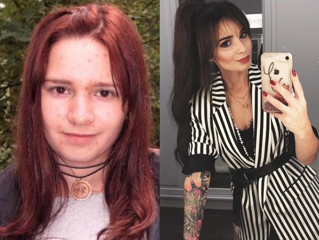 Ewelina Lisowska przyznała się do powiększenia ust. "Ból był straszny. Współczuję dziewczynom, które robią to regularnie"