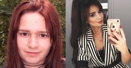 Ewelina Lisowska przyznała się do powiększenia ust. "Ból był straszny. Współczuję dziewczynom, które robią to regularnie"