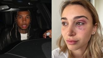 Tyga POBIŁ DZIEWCZYNĘ? Raper został aresztowany przez policję!