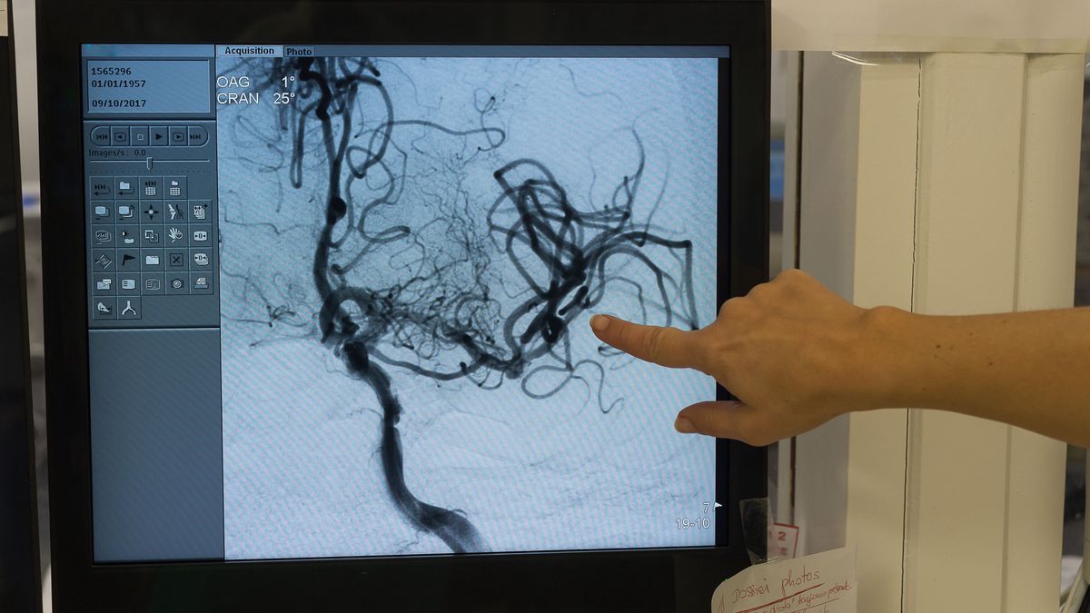 Wysokie CRP ostrzega o toczącym się w organizmie stanie zapalnym