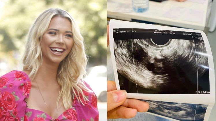 Sandra Kubicka pokazała USG jajników