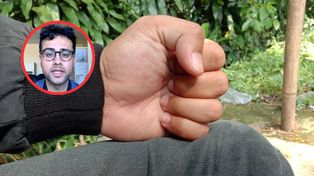 Trzy ruchy dłoni mogą ujawnić problemy z pracą mózgu. Neurolog pokazuje prosty test