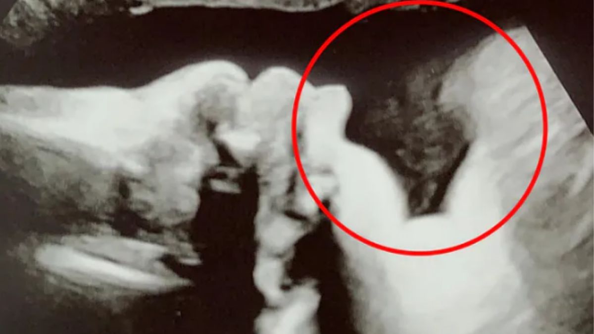 Zdjęcie USG Jade Sinfield 