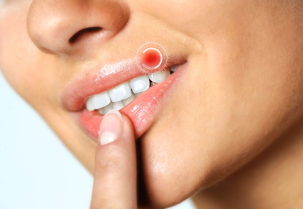 Mity na temat opryszczki