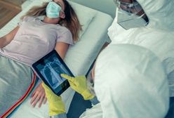 Koronawirus. Prawie połowa zakażeń przebiega bezobjawowo. Ale nawet wtedy może dojść do chorobowych zmian w płucach