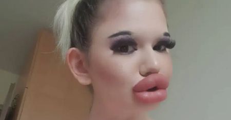 "Żywa Barbie" chce kolejnych zabiegów. Lekarze ostrzegają, że to może ją zabić