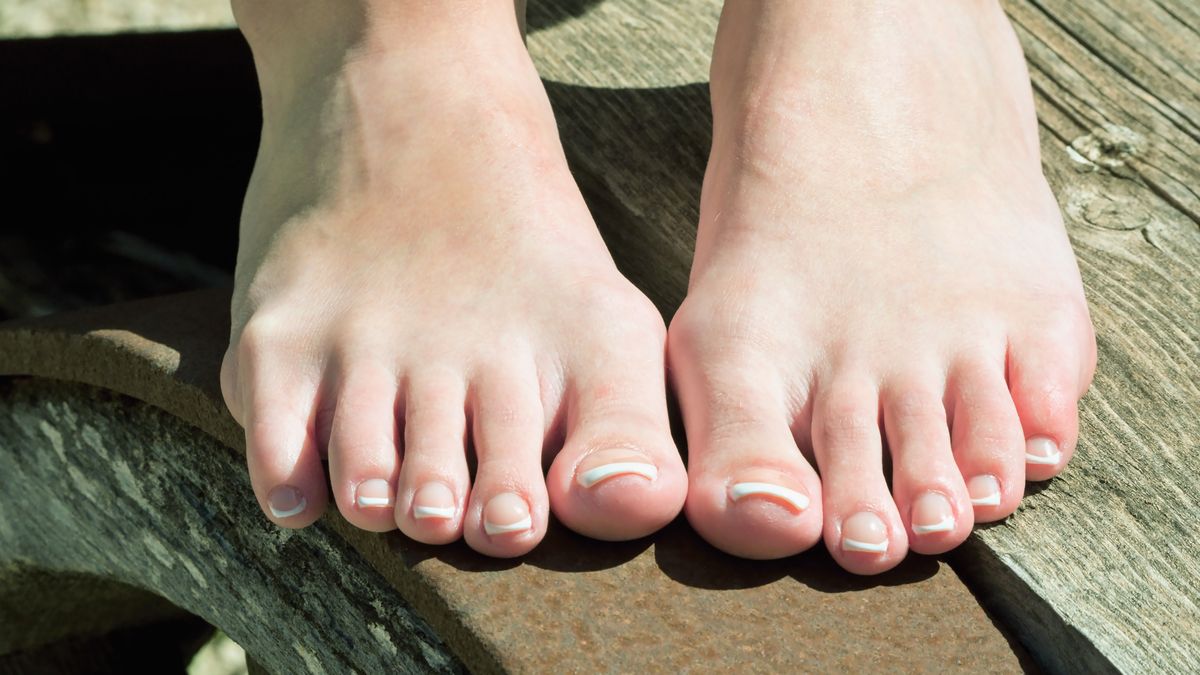 Żółty kolor paznokci może być objawem poważnej choroby