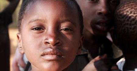 Nowe ogniwa zagrożenia wirusem Mpox w Afryce Zachodniej: Liberia, Ghana i Wybrzeże Kości Słoniowej na cenzurowanym