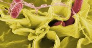 Salmonella w ośrodku wypoczynkowym w Pogorzelicy: 122 osoby zarażone.