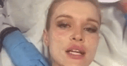 Joanna Krupa opublikowała film, na którym poddaje się "wampirzemu liftingowi" [wideo]