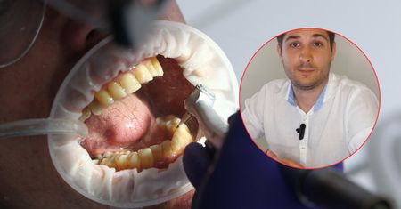 Sepsa, a nawet śmierć. Tym dla pacjentów onkologicznych mogą się skończyć niewyleczone zęby