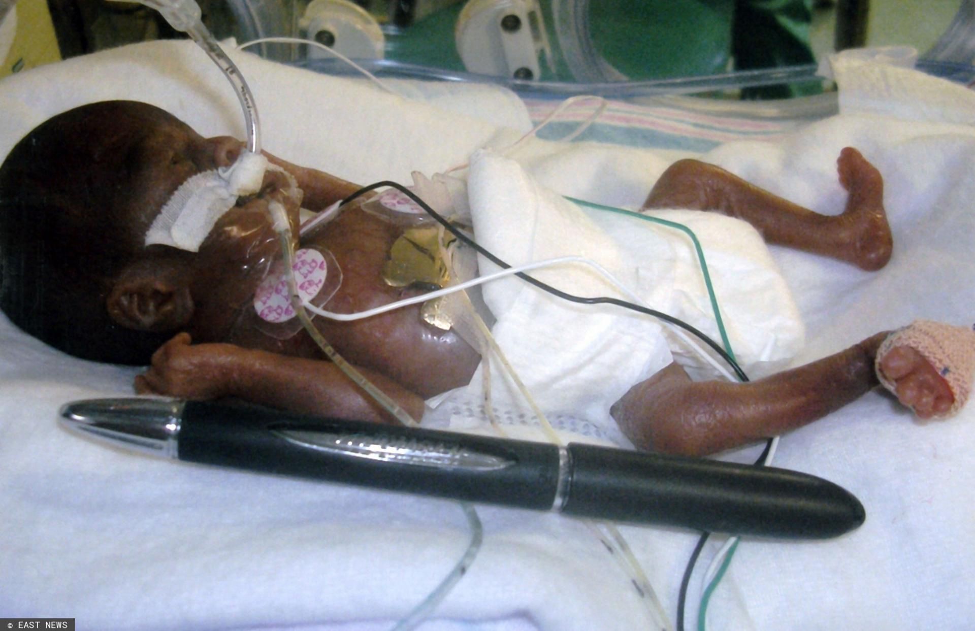 Amilia Taylor po narodzinach (East News)