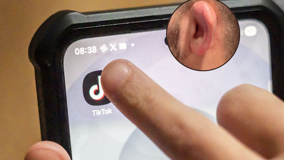 Kalafiorowe uszy to nowy tren na TikToku