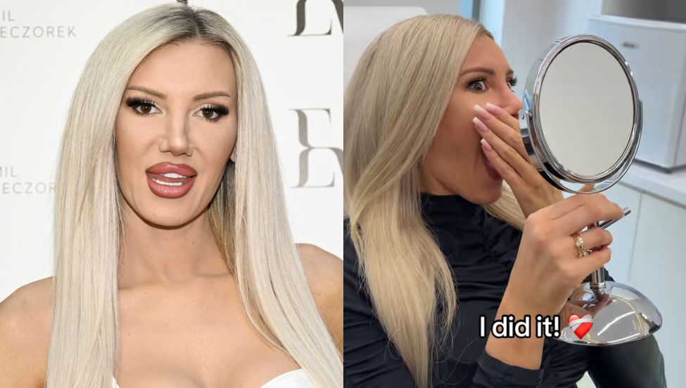 "Coś poszło nie tak". Maluba reaguje na krytykę swojego nowego nosa