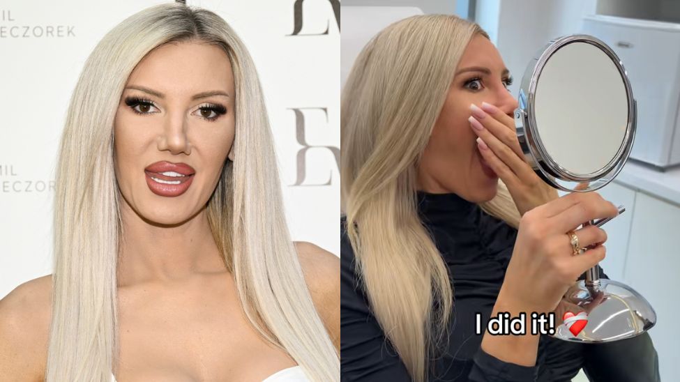 Maluba pokazała nos po operacji. Odpowiedziała na krytykę