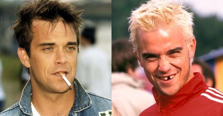 Robbie Williams wcierał kokainę w zęby. Dziś może się poszczycić wyjątkowym UZĘBIENIEM. Ładnie się prezentuje?