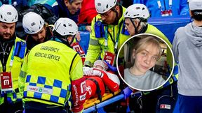 Tak wygląda twarz Polki po okropnym wypadku. Jej słowa mówią wszystko