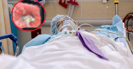 Skarżył się na ból brzucha. To znaleźli w jelitach 9-latka