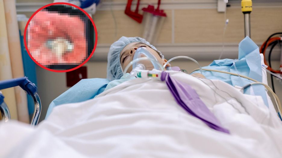 To znaleźli w jelitach 9-latka