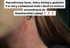 Dramatyczny apel młodej dziewczyny. "Poszukiwany facet, który mnie dusił"