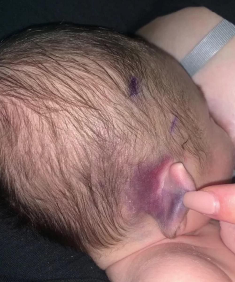 Maluch spadł na wyłożoną kafelkami podłogę