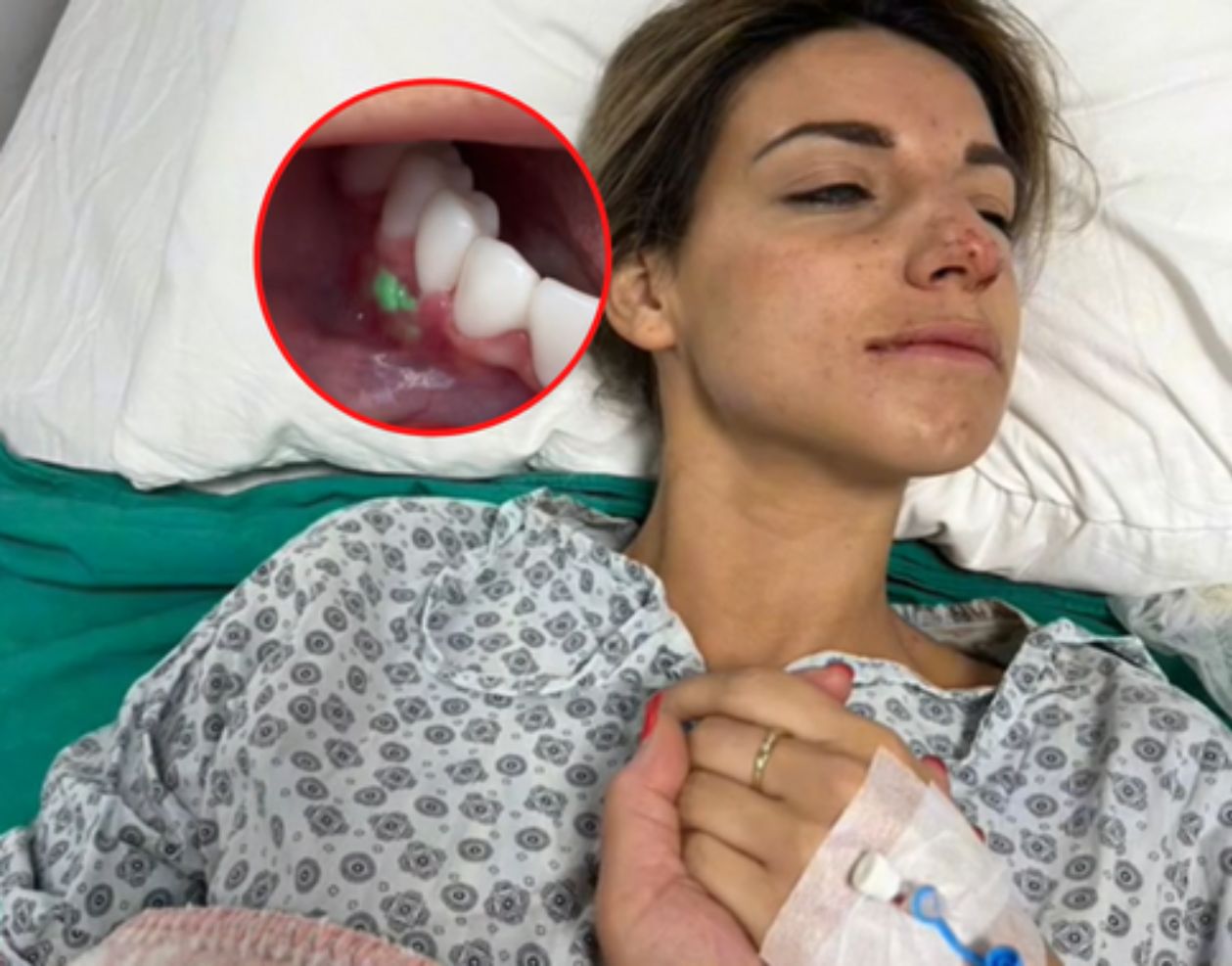 Pojechała do Turcji, by zrobić sobie zęby. "Najgorsze uczucie w życiu"