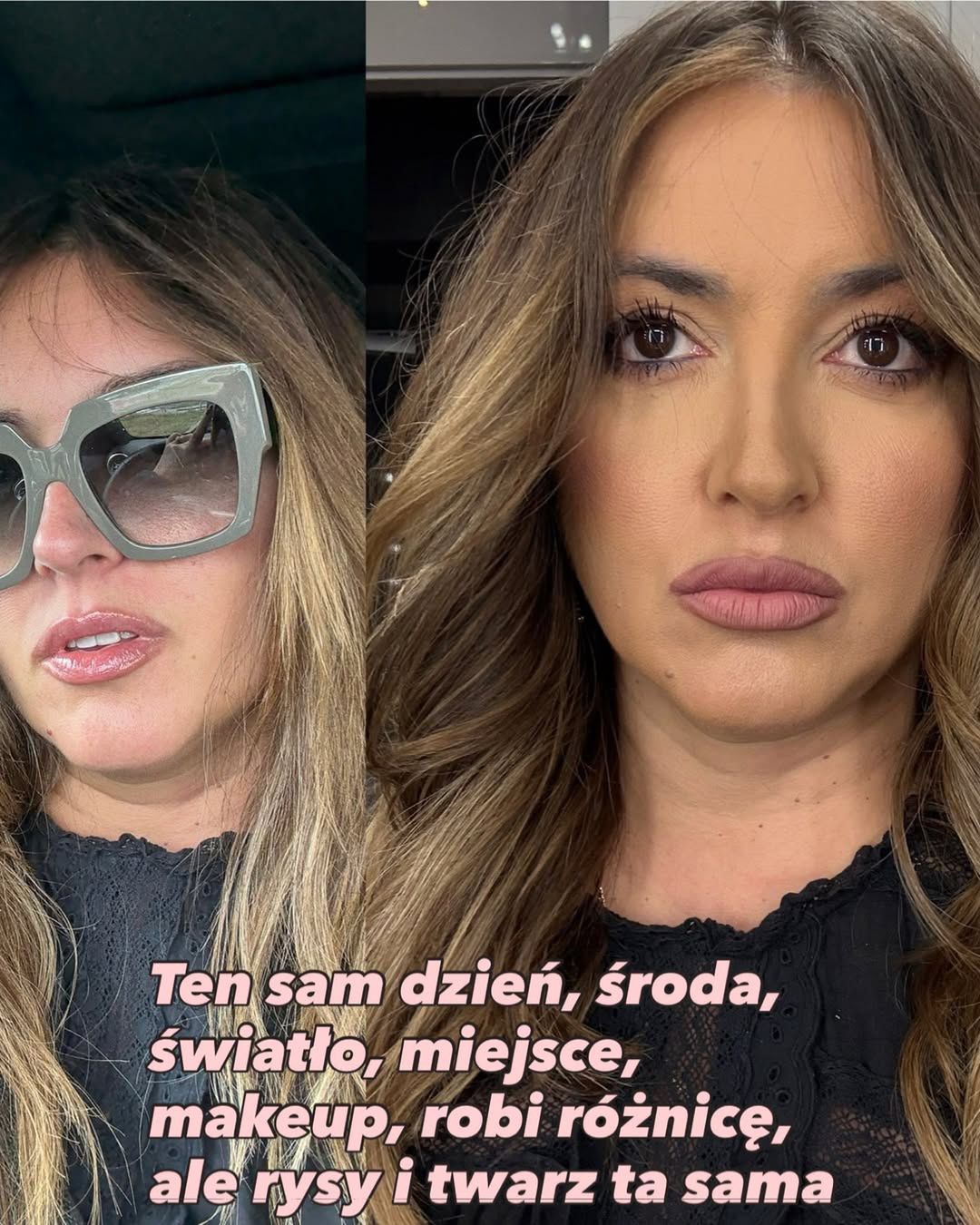 Karolina Szostak pokazała zmiany w wyglądzie twarzy