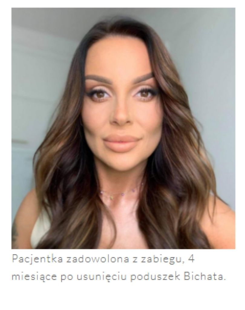 Ata z "Hotelu Paradise" usunęła torebki tłuszczowe z policzków 