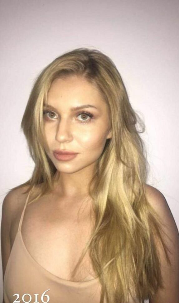 Martyna Kondratowicz pokazała zdjęcia sprzed operacji plastycznych 