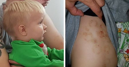 Matka 1,5-rocznego chłopca doznała szoku, kiedy odebrała go z przedszkola. "Nie mogłam odkleić koszulki od jego ciała"