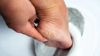 Zalej wodą i wymocz stopy. Będą gładkie jak u niemowlaka