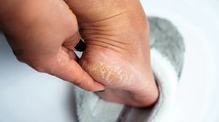 Zalej wodą i wymocz stopy. Będą gładkie jak u niemowlaka