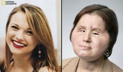 Film „Nowa twarz, nowe życie” w National Geographic