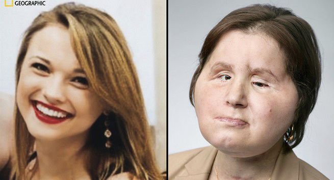 Film „Nowa twarz, nowe życie” w National Geographic