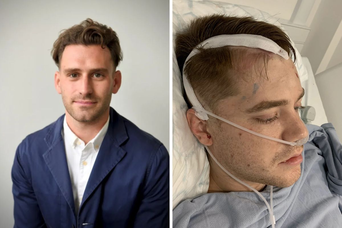 Pierwszym objawem był "zapach palonej gumy". U 34-latka zdiagnozowano agresywny guz mózgu